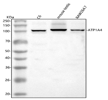 ATP1A4 Rabbit Polyclonal Antibody