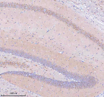 STRIP1 Rabbit Polyclonal Antibody