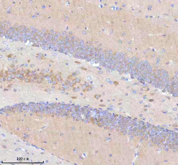 STRIP1 Rabbit Polyclonal Antibody