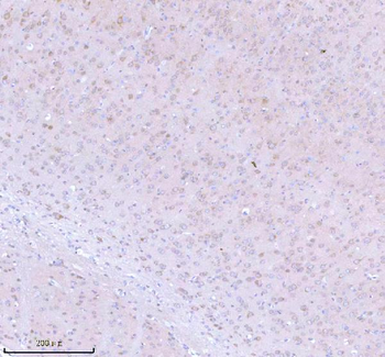 STRIP1 Rabbit Polyclonal Antibody