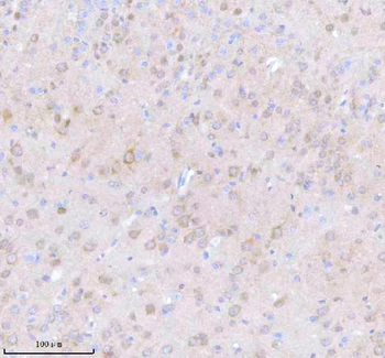 STRIP1 Rabbit Polyclonal Antibody