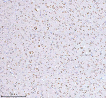 STRIP1 Rabbit Polyclonal Antibody