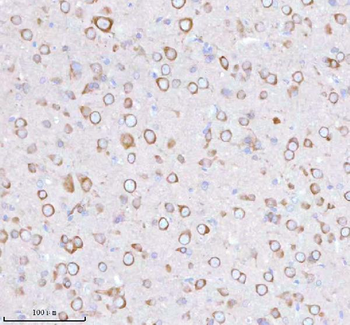 STRIP1 Rabbit Polyclonal Antibody