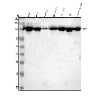 STRIP1 Rabbit Polyclonal Antibody