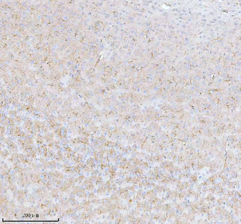 STRBP Rabbit Polyclonal Antibody
