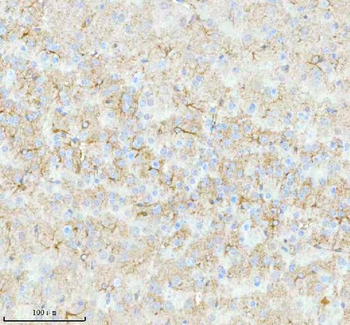 STRBP Rabbit Polyclonal Antibody