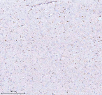 STRBP Rabbit Polyclonal Antibody