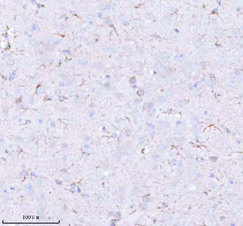 STRBP Rabbit Polyclonal Antibody