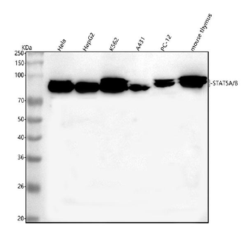 STAT5A/B Rabbit Polyclonal Antibody