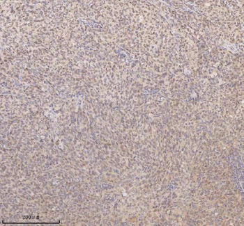 SSX2IP Rabbit Polyclonal Antibody