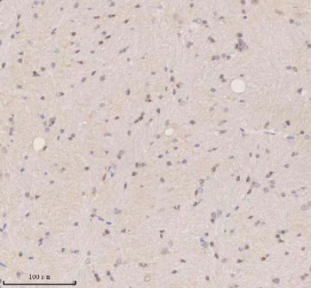 SSX2IP Rabbit Polyclonal Antibody