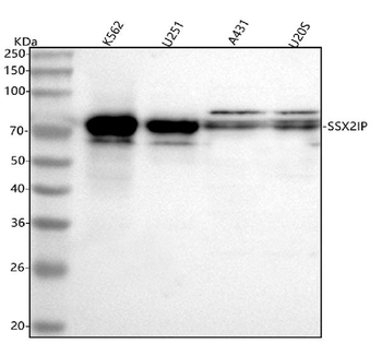 SSX2IP Rabbit Polyclonal Antibody
