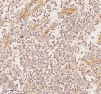 SSSCA1/ZNRD2 Rabbit Polyclonal Antibody