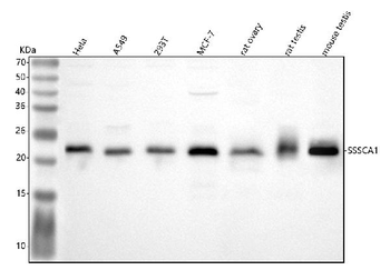SSSCA1/ZNRD2 Rabbit Polyclonal Antibody