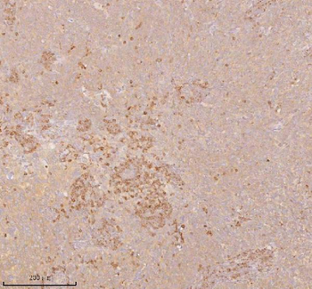 SSSCA1/ZNRD2 Rabbit Polyclonal Antibody
