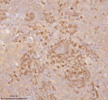 SSSCA1/ZNRD2 Rabbit Polyclonal Antibody