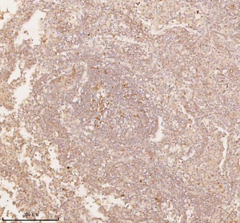 SSSCA1/ZNRD2 Rabbit Polyclonal Antibody
