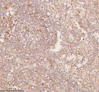 SSSCA1/ZNRD2 Rabbit Polyclonal Antibody