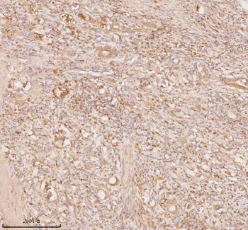 SSSCA1/ZNRD2 Rabbit Polyclonal Antibody