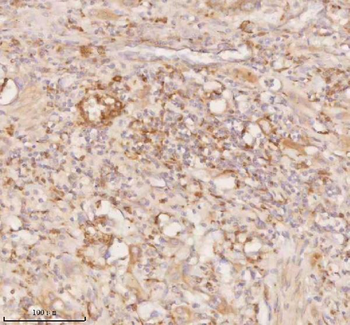 SSSCA1/ZNRD2 Rabbit Polyclonal Antibody