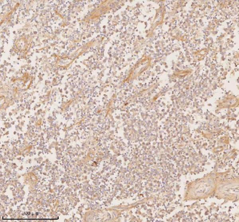 SSSCA1/ZNRD2 Rabbit Polyclonal Antibody