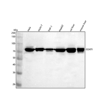 SOAT1 Antibody