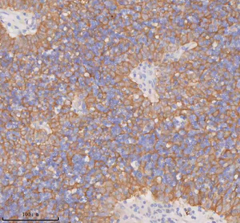 DDX58/RIG-1 Antibody