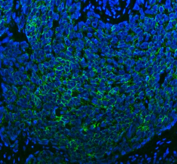 SPA17 Rabbit Polyclonal Antibody