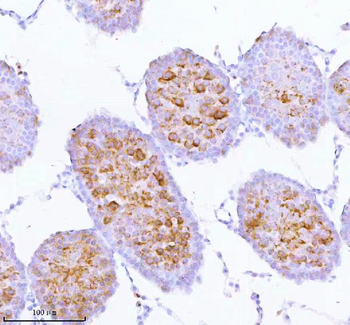 SPA17 Rabbit Polyclonal Antibody