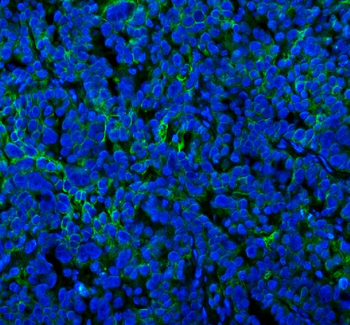 SPA17 Rabbit Polyclonal Antibody
