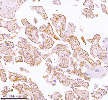 SPA17 Rabbit Polyclonal Antibody