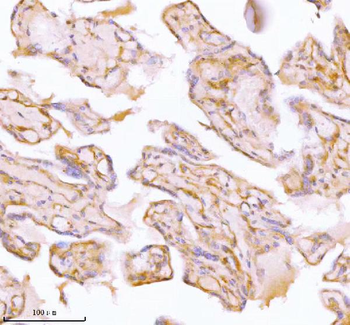 SPA17 Rabbit Polyclonal Antibody