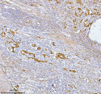 SPA17 Rabbit Polyclonal Antibody
