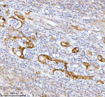 SPA17 Rabbit Polyclonal Antibody