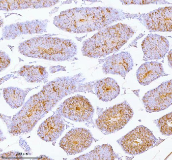 SPA17 Rabbit Polyclonal Antibody