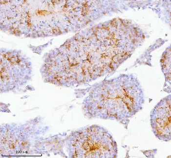 SPA17 Rabbit Polyclonal Antibody