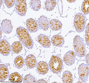 SPA17 Rabbit Polyclonal Antibody