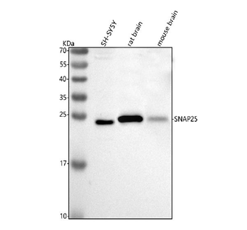 SNAP25 Rabbit Polyclonal Antibody