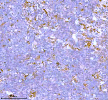 Stanniocalcin 2/STC2 Antibody