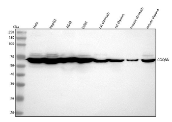 COQ8B Antibody