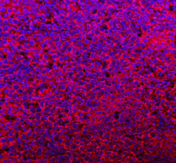COQ8B Antibody