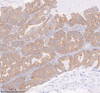 COQ8B Antibody