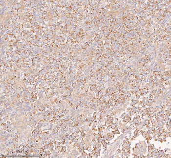 COQ8B Antibody