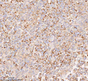 COQ8B Antibody
