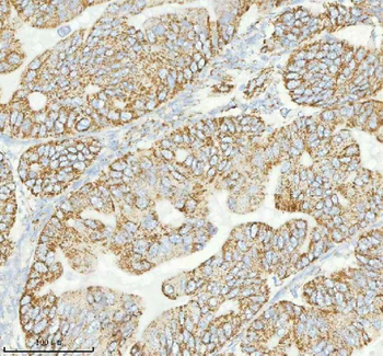 HERP/HERPUD1 Antibody