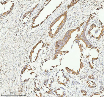 HERP/HERPUD1 Antibody
