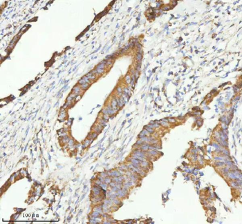 HERP/HERPUD1 Antibody
