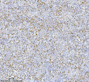 HERP/HERPUD1 Antibody