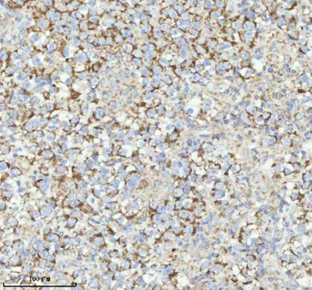 HERP/HERPUD1 Antibody