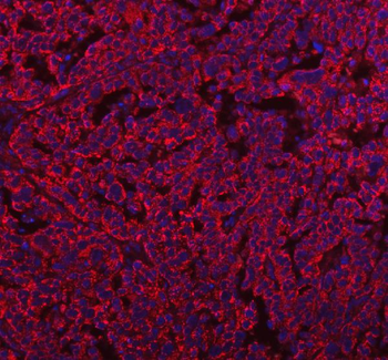 HERP/HERPUD1 Antibody